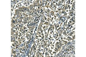 IHC analysis of EIF4A1 using anti-EIF4A1 antibody (ABIN7603125).