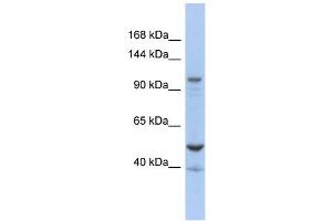 DDX58 antibody used at 1 ug/ml to detect target protein. (DDX58 anticorps)