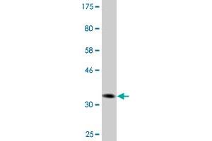 Western Blot detection against Immunogen (36. (DVL3 anticorps  (AA 1-100))