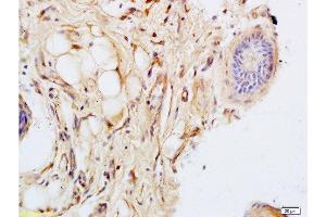 Formalin-fixed and paraffin embedded rat skin tissue labeled with Anti-CK14 Polyclonal Antibody, Unconjugated at 1:200 followed by conjugation to the secondary antibody and DAB staining