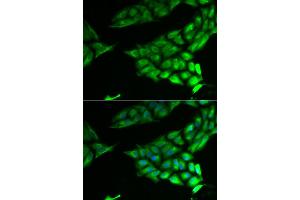 Immunofluorescence analysis of U2OS cell using PSAT1 antibody. (PSAT1 anticorps)