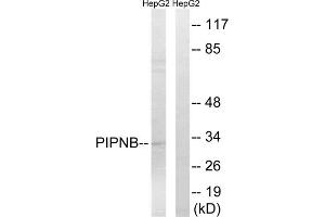 Western blot analysis of extracts from HepG2 cells, using PITPNB antibody. (PITPNB anticorps  (Internal Region))