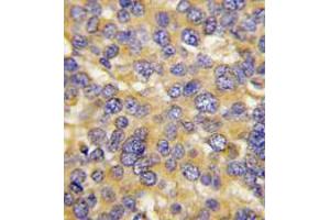 Image no. 3 for anti-DKK3 (N-Term) antibody (ABIN357071)