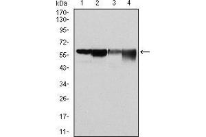 Western blot analysis using G6PD mouse mAb against Hela (1), MCF-7 (2), Jurkat (3) and K562 (4) cell lysate. (Glucose-6-Phosphate Dehydrogenase anticorps)