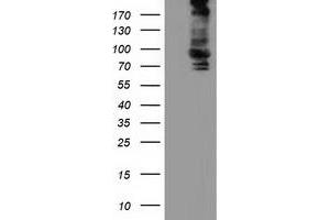 Western Blotting (WB) image for anti-Aldehyde Dehydrogenase 1 Family, Member L1 (ALDH1L1) antibody (ABIN1496583)