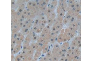 Used in DAB staining on fromalin fixed paraffin- embedded Kidney tissue