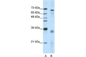 WB Suggested Anti-SFRS1 Antibody Titration:  5. (SRSF1 anticorps  (Middle Region))