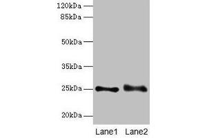 Western blot All lanes: RAB3B antibody at 4 μg/mL Lane 1: Mouse brain tissue Lane 2: U87 whole cell lysate Secondary Goat polyclonal to rabbit IgG at 1/10000 dilution Predicted band size: 25 kDa Observed band size: 25 kDa (RAB3B anticorps  (AA 1-219))
