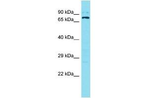 Western Blotting (WB) image for anti-Sosondowah Ankyrin Repeat Domain Family Member B (SOWAHB) (C-Term) antibody (ABIN2791404) (SOWAHB anticorps  (C-Term))