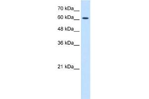 WB Suggested Anti-CHRNE Antibody Titration:  1. (CHRNE anticorps  (N-Term))
