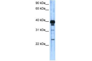 WB Suggested Anti-ZSCAN16 Antibody Titration:  0. (ZSCAN16 anticorps  (C-Term))