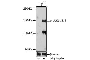 Western blot analysis of extracts of 293T cells, using Phospho-ULK1-S638 antibody (ABIN7271219) at 1:1000 dilution. (ULK1 anticorps  (pSer638))