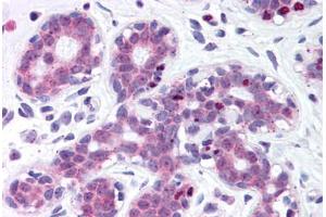 anti-Inter-alpha Trypsin Inhibitor, Heavy Chain 1 (ITIH1) (AA 410-592) antibody