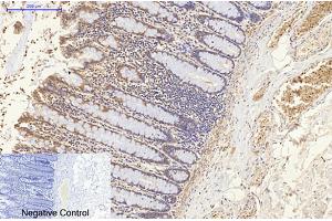 Immunohistochemical analysis of paraffin-embedded human colon tissue. (ENO2/NSE anticorps)