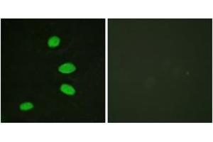 Immunofluorescence analysis of HeLa cells, using RBL2 (Ab-952) Antibody.