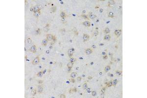 Immunohistochemistry of paraffin-embedded rat brain using ISG15 Antibody (ABIN5970528) at dilution of 1/100 (40x lens). (ISG15 anticorps)