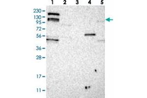 Western blot analysis of Lane 1: RT-4, Lane 2: U-251 MG, Lane 3: Human Plasma, Lane 4: Liver, Lane 5: Tonsil with ARHGEF10L polyclonal antibody . (ARHGEF10L anticorps)