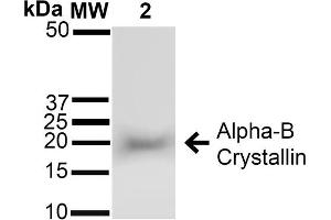 Western blot analysis of Rat Brain cell lysates showing detection of ~22 kDa Alpha B Crystallin protein using Rabbit Anti-Alpha B Crystallin Polyclonal Antibody (ABIN361836 and ABIN361837). (CRYAB anticorps)