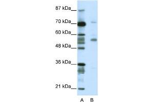 WB Suggested Anti-CORO1A Antibody Titration:  2. (Coronin 1a anticorps  (N-Term))