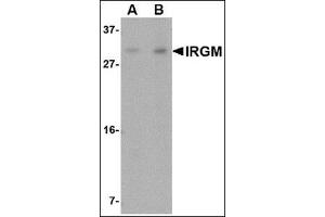 Western blot analysis of IRGM in Rat brain lysate with this product at (A) 1 and (B) 2 μg/ml. (IRGM anticorps  (N-Term))