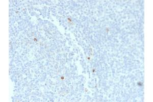Formalin-fixed, paraffin-embedded human Tonsil stained with IgM Mouse Recombinant Monoclonal Antibody (rIM373). (Recombinant IGHM anticorps)