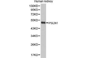 Western Blotting (WB) image for anti-Presenilin 1 (PSEN1) (AA 1-160) antibody (ABIN3023160) (Presenilin 1 anticorps  (AA 1-160))