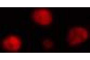 ABIN6274319 staining HeLa cells by IF/ICC.