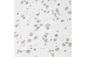 Immunohistochemistry of paraffin-embedded mouse brain using CHD1 antibody at dilution of 1:100 (x40 lens). (CHD1 anticorps)