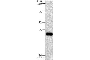 Western blot analysis of Human colon cancer tissue, using SLC39A6 Polyclonal Antibody at dilution of 1:500 (SLC39A6 anticorps)