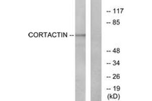 Western blot analysis of extracts from HeLa cells, treated with H2O2, using Cortactin (Ab-421) Antibody. (Cortactin anticorps  (AA 388-437))