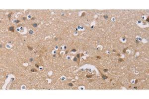Immunohistochemistry of paraffin-embedded Human brain using FXYD1 Polyclonal Antibody at dilution of 1:60 (FXYD1 anticorps)