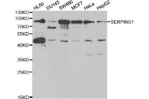 Western blot analysis of extracts of various cell lines, using SERPING1 antibody. (SERPING1 anticorps  (AA 201-500))