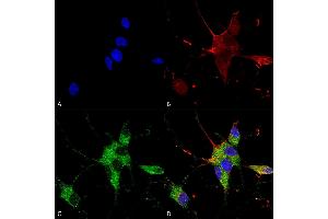 Immunocytochemistry/Immunofluorescence analysis using Mouse Anti-SHANK1/SHANK3 Monoclonal Antibody, Clone S367-51 (ABIN1741252).
