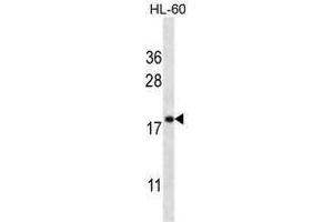 TMM70 Antibody (C-term) western blot analysis in HL-60 cell line lysates (35 µg/lane). (Transmembrane Protein 70 (TMM70) (AA 230-260), (C-Term) anticorps)