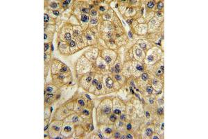 Immunohistochemistry (IHC) image for anti-Adaptor-Related Protein Complex 2, alpha 2 Subunit (AP2A2) antibody (ABIN3003799)