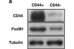 Higher expression of FoxM1 is found in CD44+ HCT-15 cells, which are more sensitive to thiostrepton.