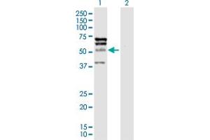 Western Blot analysis of ELK4 expression in transfected 293T cell line by ELK4 MaxPab polyclonal antibody. (ELK4 anticorps  (AA 1-405))