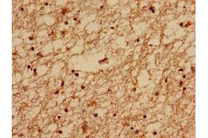 Immunohistochemistry analysis of human brain tissue using ABIN7159132 at dilution of 1:100