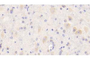 Detection of APP in Mouse Cerebellum Tissue using Polyclonal Antibody to Amyloid Precursor Protein (APP) (APP anticorps  (AA 18-286))