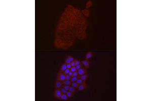 Immunofluorescence analysis of A-431 using S100 antibody (ABIN7270123) at dilution of 1:25 (40x lens).