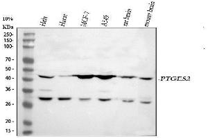 Western blot analysis of PTGES2/Gbf1 using anti-PTGES2/Gbf1 antibody (ABIN7599616).