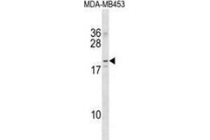 Western blot analysis in MDA-MB453 cell line lysates (35ug/lane) using NKAIN2  Antibody . (NKAIN2 anticorps  (Middle Region))