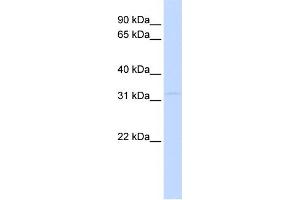 WB Suggested Anti-PITPNB Antibody Titration: 0. (PITPNB anticorps  (Middle Region))