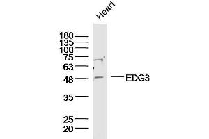 Mouse heart lysates probed with EDG3 Polyclonal Antibody, unconjugated  at 1:300 overnight at 4°C followed by a conjugated secondary antibody at 1:10000 for 90 minutes at 37°C. (S1PR3 anticorps  (AA 145-250))