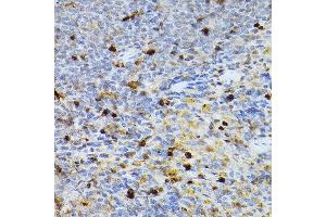 Immunohistochemistry of paraffin-embedded rat spleen using SERPINB1 Rabbit pAb (ABIN6131408, ABIN6147583, ABIN6147584 and ABIN6221861) at dilution of 1:100 (40x lens).