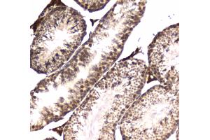 IHC analysis of POLR2A using anti-POLR2A antibody .