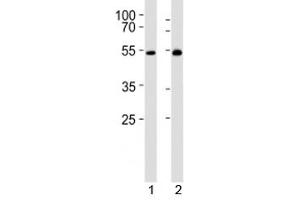 Western blot analysis of lysate from 1) mouse thymus and 2) rat thymus tissue lysate using LCK antibody at 1:1000.