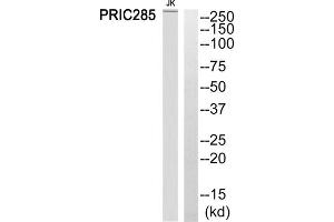 Western blot analysis of extracts from Jurkat cells, using PRIC285 antibody. (HELZ2 anticorps  (Internal Region))