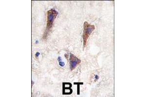 Formalin-fixed and paraffin-embedded human brain tissue reacted with CDH12 antibody , which was peroxidase-conjugated to the secondary antibody, followed by DAB staining.