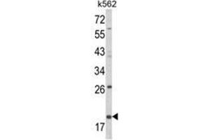 Western blot analysis of KLRD1 Antibody (N-term) in K562 cell line lysates (35ug/lane). (CD94 anticorps  (N-Term))